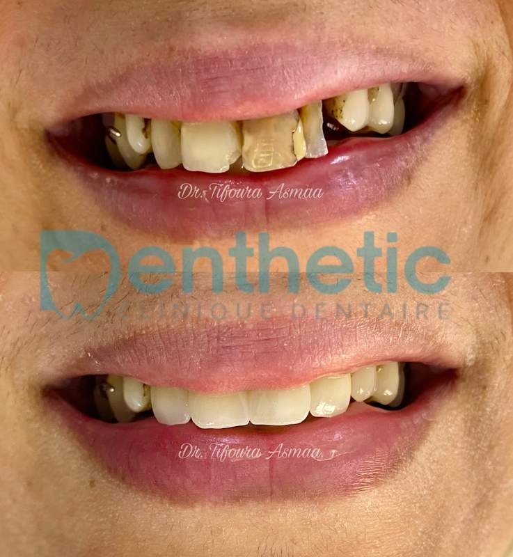 DENTHETIC Clinique dentaire Dr Tifoura.A